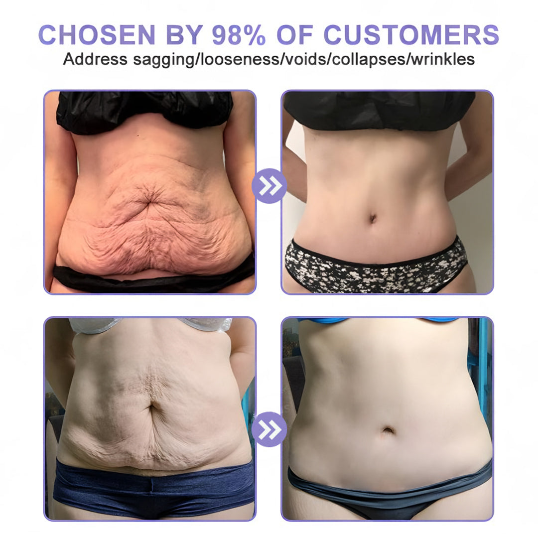 【Official Brand】 ODEIUN™ Body Firming Cream – Smooth, Tighten & Restore Sagging Skin