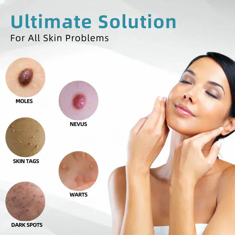 🔥Seurico™ VelvetSkin+ All-in-One Laser Eraser Pen✨ | Safe & Easy At-Home Solution for Smooth, Spot-Free Skin 💆‍♀️🌟