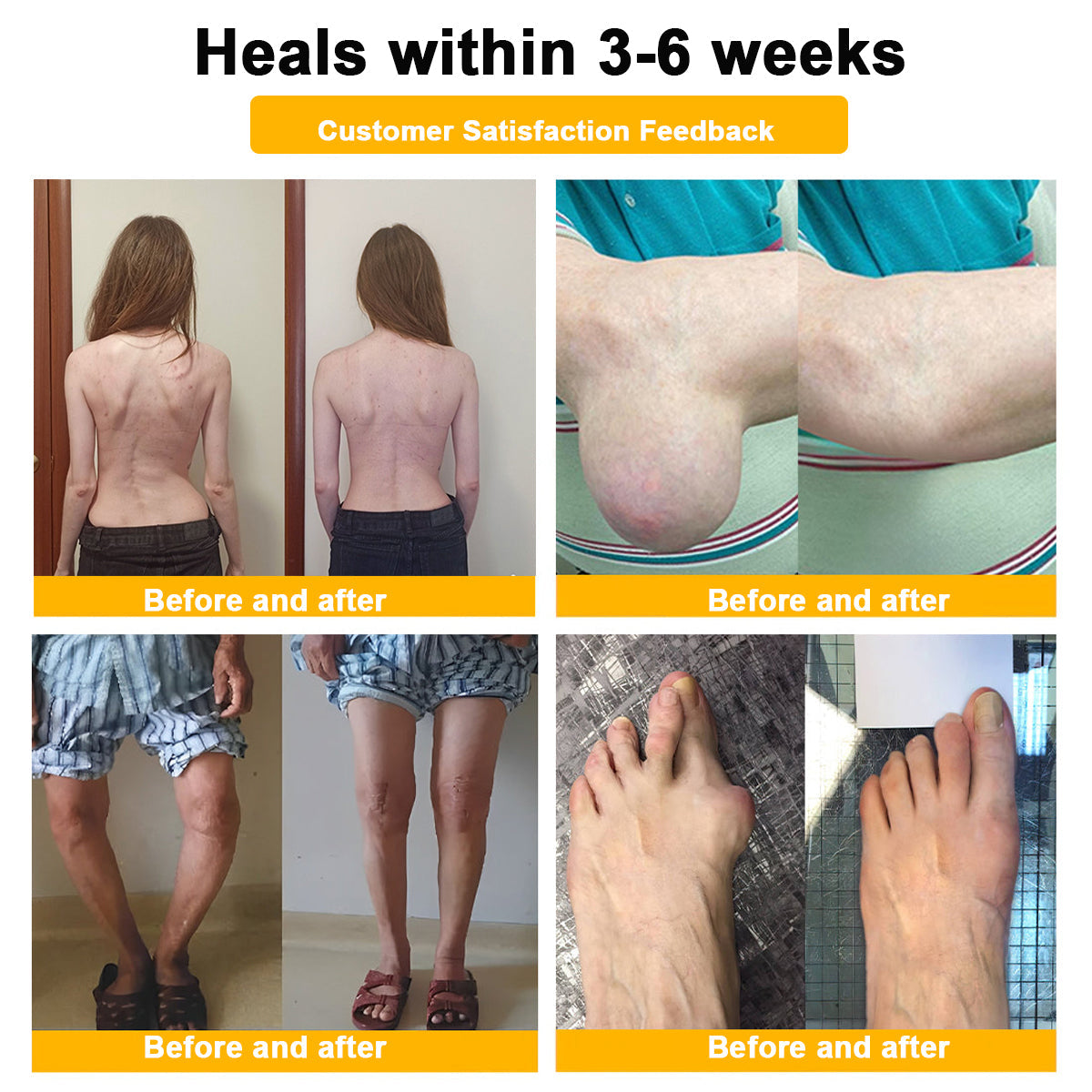 🎁Flash Sale Odeiun™ Botulinum Toxin & Bee Venom Pain-Relief Bone Healing Cream