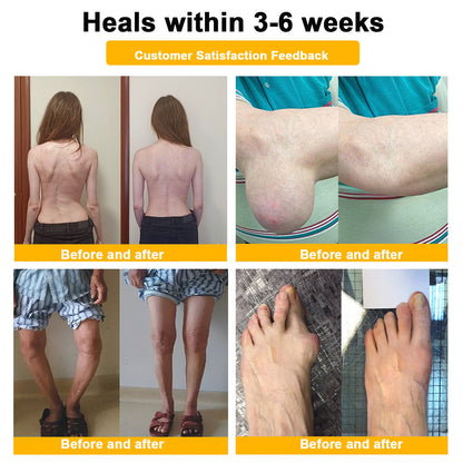 🎁Flash Sale Odeiun™ Botulinum Toxin & Bee Venom Pain-Relief Bone Healing Cream