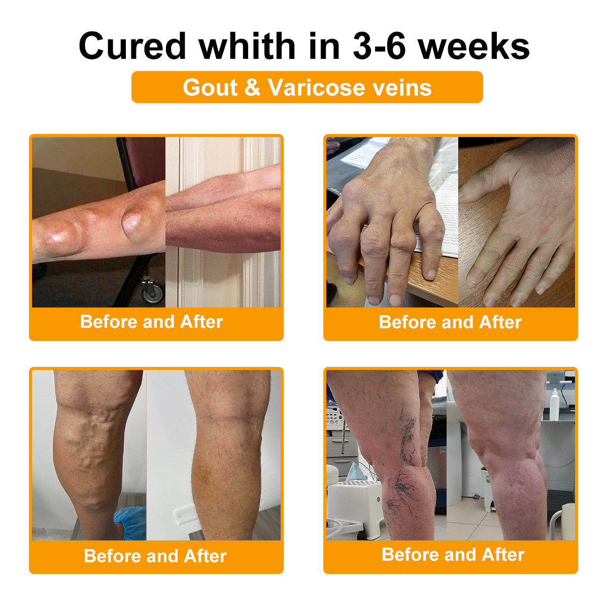 🎁Flash Sale Odeiun™ Botulinum Toxin & Bee Venom Pain-Relief Bone Healing Cream