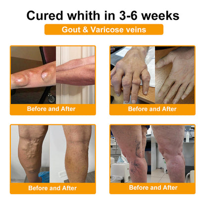 🎁Flash Sale Odeiun™ Botulinum Toxin & Bee Venom Pain-Relief Bone Healing Cream