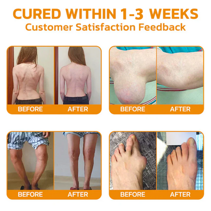 ✅Official Store: Negusy™ Lidocaine Scar-Free Pain Relief Healing Liquid👨‍⚕️USA Osteopathic Medical Association （AAOS）Approved(Reducing joint swelling, pain, stiffness, redness, warmth, soreness and joint fatigue )✨