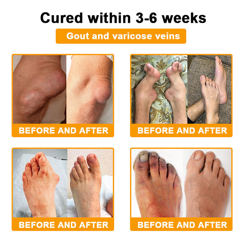 🎁Flash Sale Odeiun™ Botulinum Toxin & Bee Venom Pain-Relief Bone Healing Cream