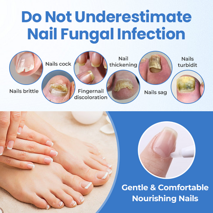 Seurico™ MycoErase Nail Revive Pen — Clear, Healthy Nails in 21 Days