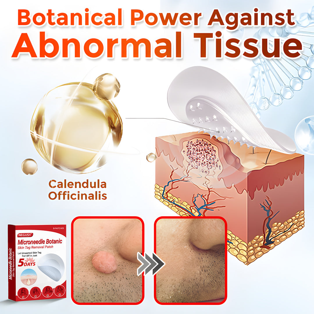 ✅Official Store | Negusy™ MicroNeedle Skin Tag Remover Patch – Made in the USA