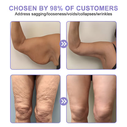 【Official Brand】 ODEIUN™ Body Firming Cream – Smooth, Tighten & Restore Sagging Skin