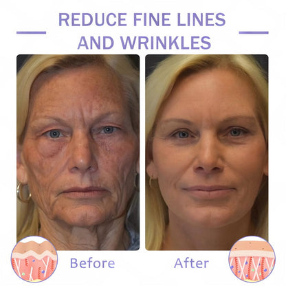 【Official Brand】 ODEIUN™ Body Firming Cream – Smooth, Tighten & Restore Sagging Skin