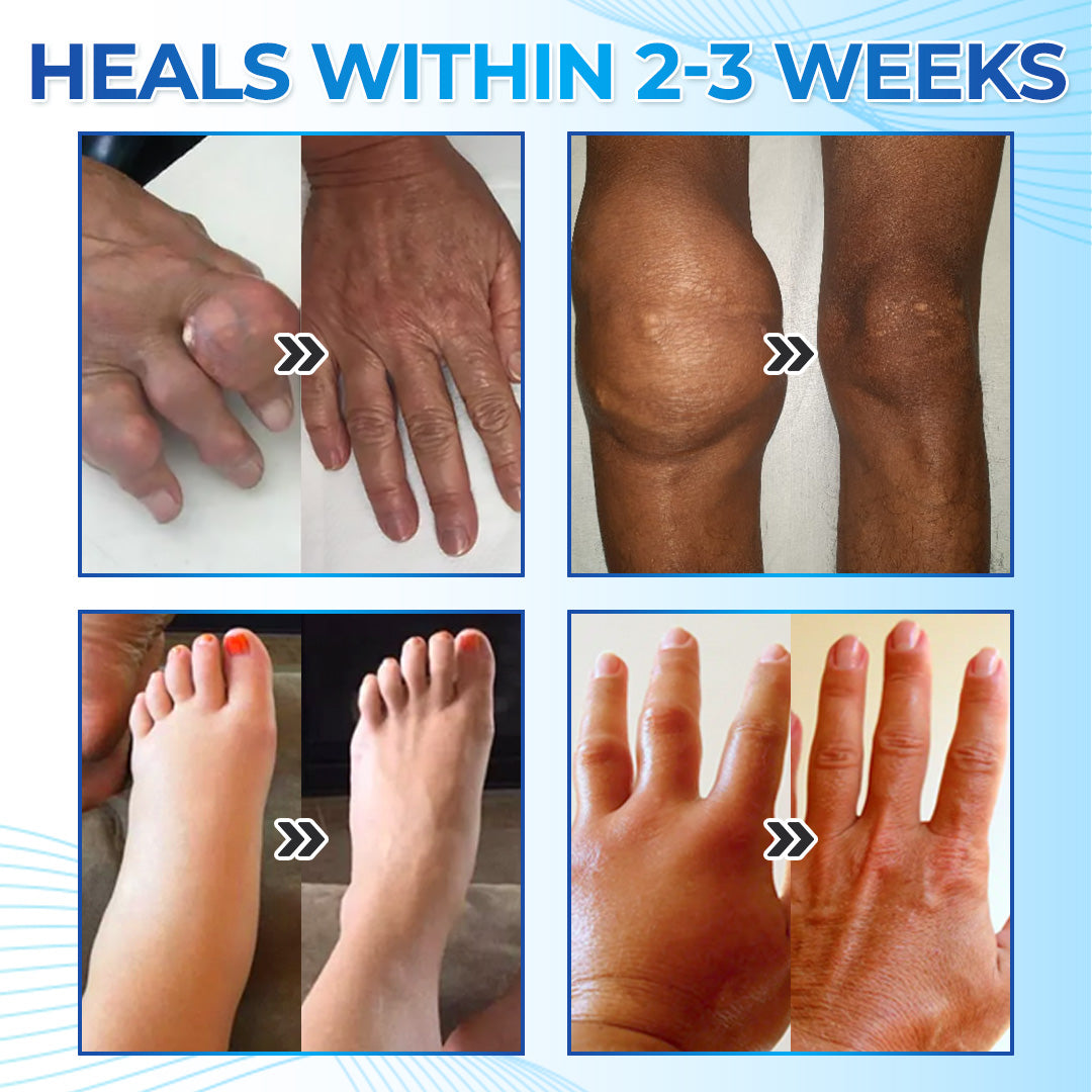 ✅ Mayo Clinic Approved: Seurico™ Magnesium Pain & Bone Healing Cream – Fast Relief for Neuropathy, Arthritis, Muscle Spasms & Injuries