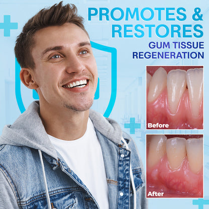 🔥Last Day 69% OFF--🦷 Negusy™ Gum Therapy Agent