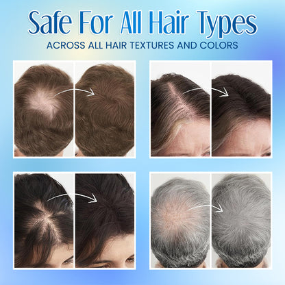 ⚡🔥Limited Time Only: Get 50% Off Now! 🎁 Supersize Color Fibers with Refill Set🎁