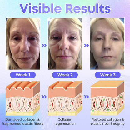 【Official Brand】 ODEIUN™ Body Firming Cream – Smooth, Tighten & Restore Sagging Skin