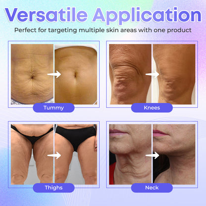 【Official Brand】 ODEIUN™ Body Firming Cream – Smooth, Tighten & Restore Sagging Skin