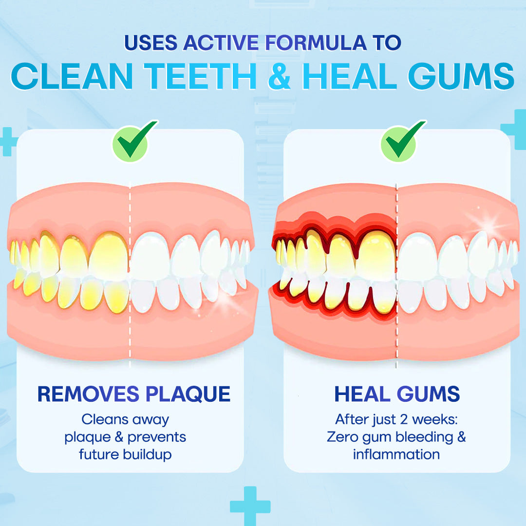 🔥Last Day 69% OFF--🦷 Negusy™ Gum Therapy Agent