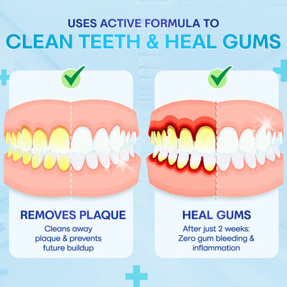 🔥Last Day 69% OFF--🦷 Negusy™ Gum Therapy Agent