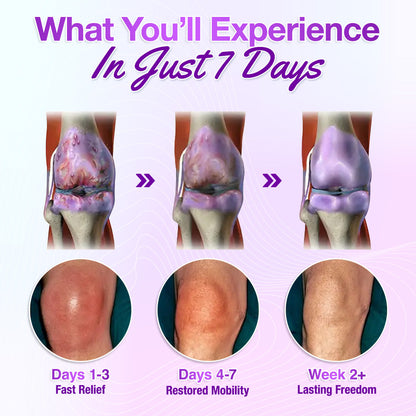 ✅[Official Store] Seurico™ Turmeric & Emu Oil Arthritis Soothing Pain Relief Massage Gel - American Orthopaedics (AAOS) Approved