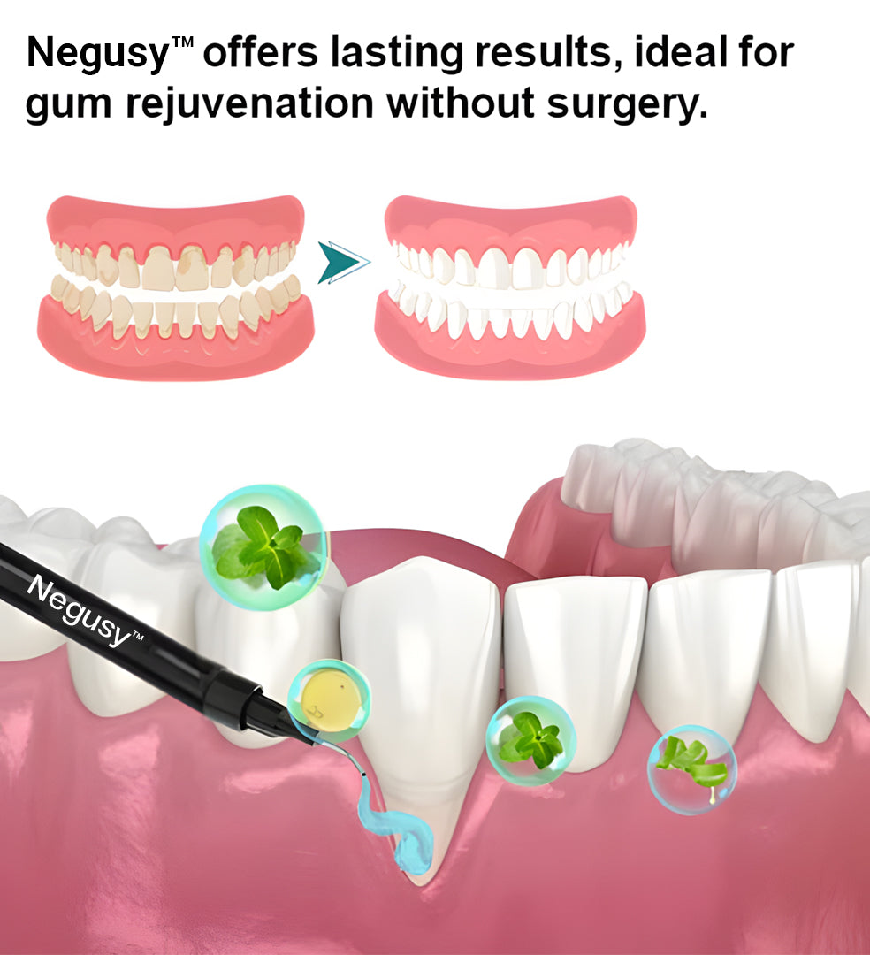 🔥Last Day 75% OFF--🦷 Negusy™ Gum Therapy Agent 🔥