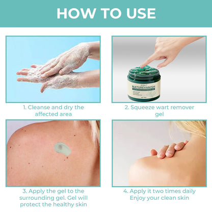 Official Boutique:  Seurico™ NatureVanish Instant Mole & Spot Removal Gel, Extracted from Natural Botanicals