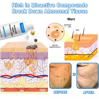 ✅Official Store:  Zakdavi™ Magnesium Herbal Psoriasis Spray – FDA Certified Relief for Psoriasis, Eczema & Skin Tags