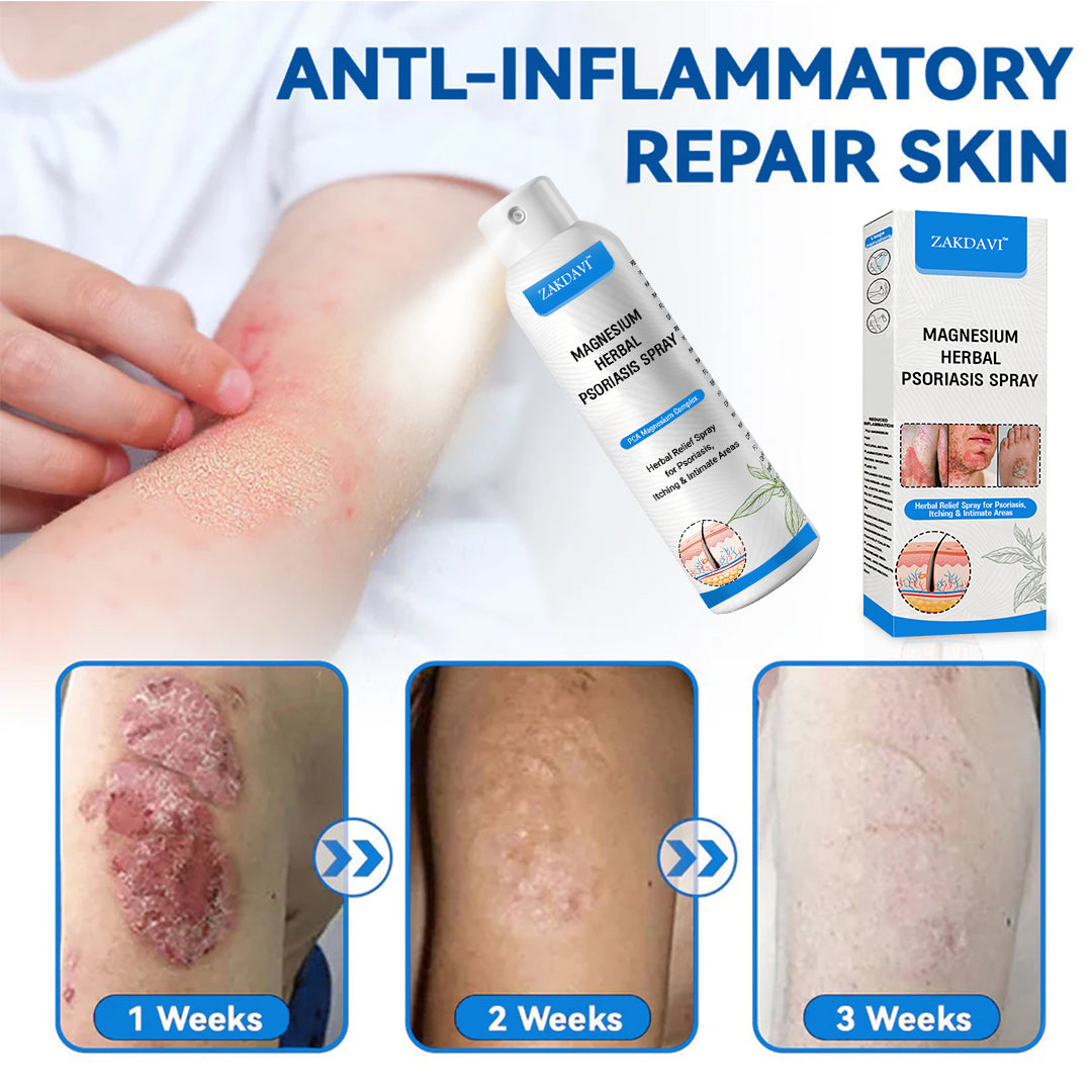 ✅Official Store:  Zakdavi™ Magnesium Herbal Psoriasis Spray – FDA Certified Relief for Psoriasis, Eczema & Skin Tags