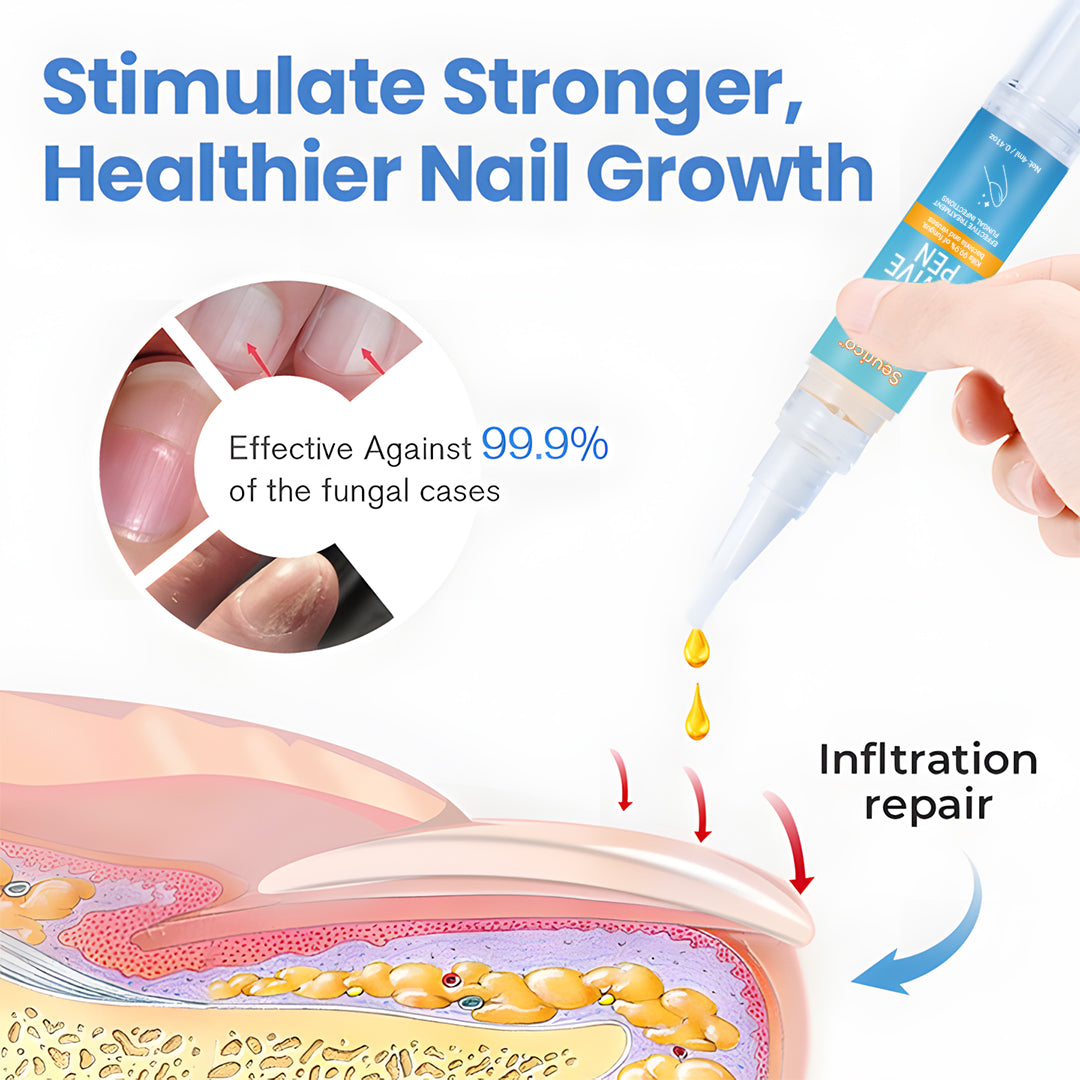 Seurico™ MycoErase Nail Revive Pen — Clear, Healthy Nails in 21 Days