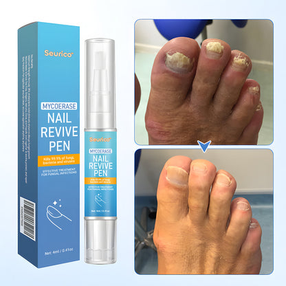 Seurico™ MycoErase Nail Revive Pen — Clear, Healthy Nails in 21 Days