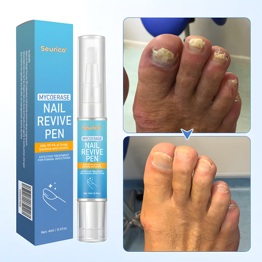 Seurico™ MycoErase Nail Revive Pen — Clear, Healthy Nails in 21 Days