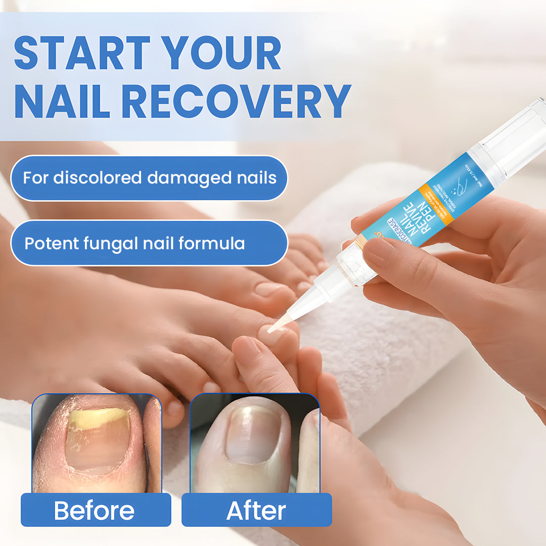 Seurico™ MycoErase Nail Revive Pen — Clear, Healthy Nails in 21 Days
