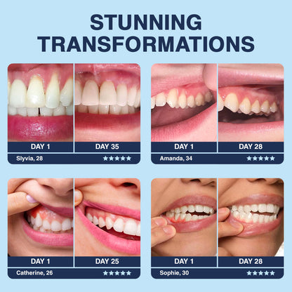 🔥🔥Odeiun™ Bee Venom Gum Repair Powder 🐝 (ADA Approved) 🎁 Flash Sale – Restore Teeth & Gums Now!