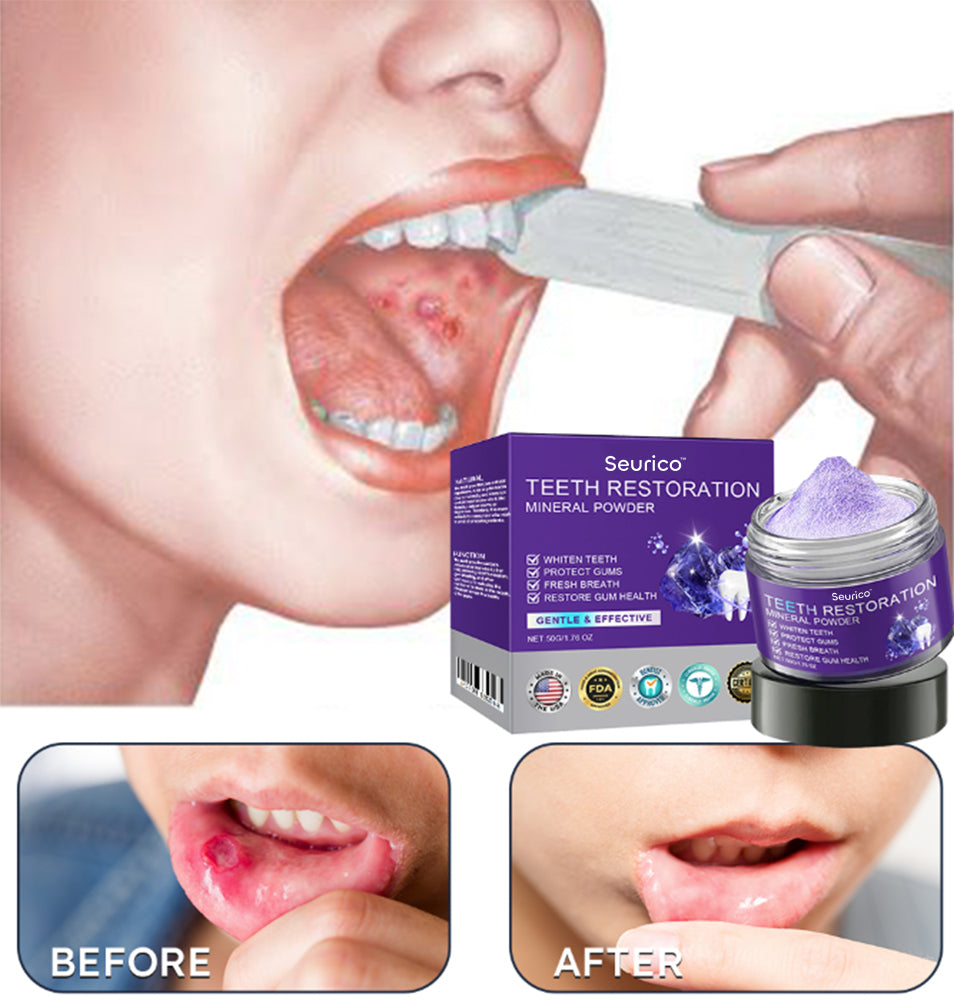 Official Store | Seurico™ Tooth Health Mineral Powder - ✅ TGA-Certified 🎁 Flash Sale - Don’t Miss Out