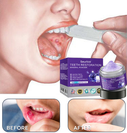 Official Store | Seurico™ Tooth Health Mineral Powder - ✅ TGA-Certified 🎁 Flash Sale - Don’t Miss Out